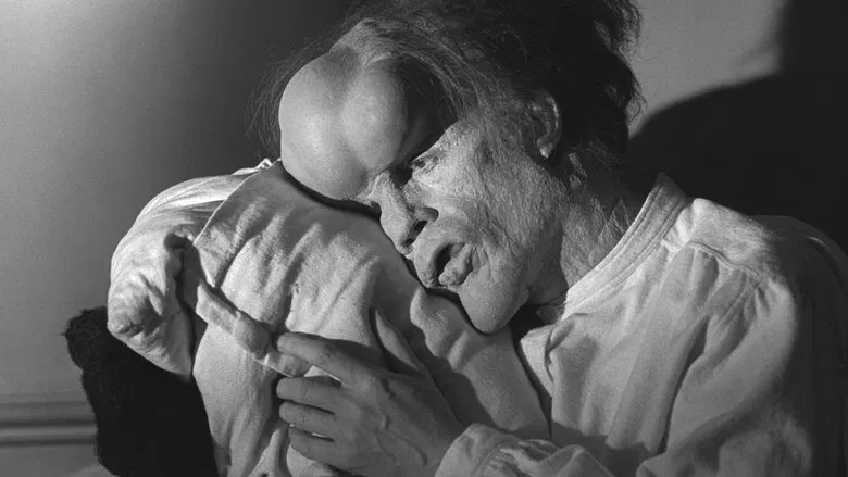 The Elephant Man still