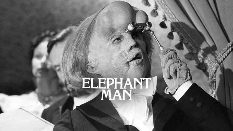The Elephant Man still