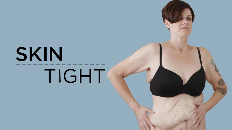 Skin Tight still